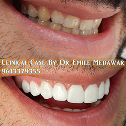 dentist lebanon