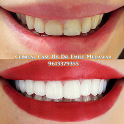 dentist lebanon