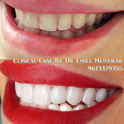 dentist lebanon beirut