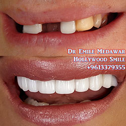 dentist lebanon