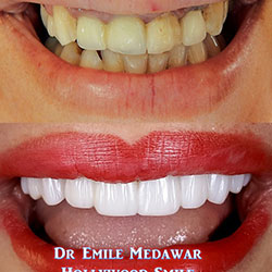 dentist lebanon