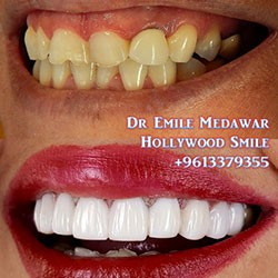 dentist beirut