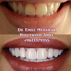 dental clinic lebanon