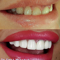 best dentist lebanon