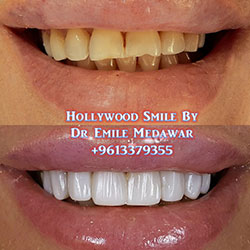 dentist lebanon beirut