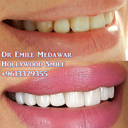 dentist dr emilemedawar