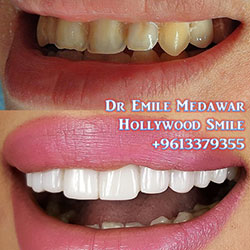 dental clinic beirut