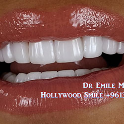 dentist lebanon beirut