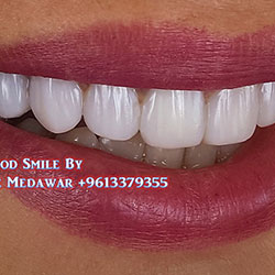 dental clinic lebanon