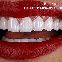 best dentist in lebanon
