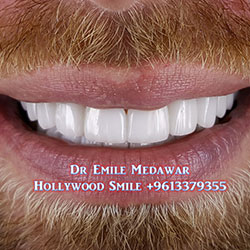 best Hollywood Smile dentist