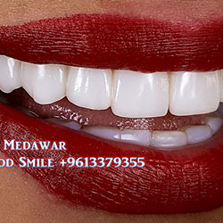 smile lebanon